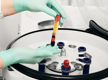 Platelet-Rich Plasma (PRP): Transforming IVF for Better Fertility