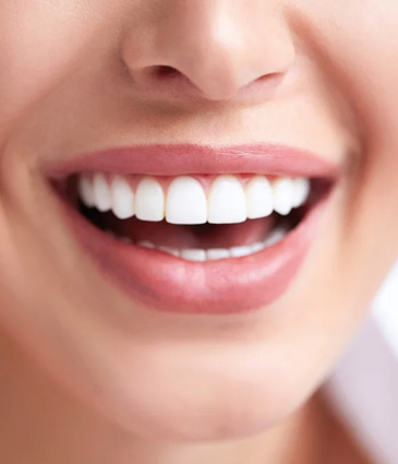 Cosmetic Dentistry Price Turkey