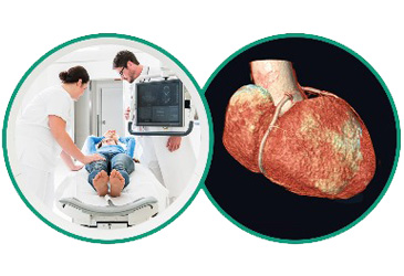 Coronary CT Angiography